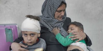 UNICEF/Mohammed Nateel Child malnutrition is on the rise in Gaza 'especially since March' when the Israeli near-total aid blockade began, says the the UN agency for Palestinians, UNRWA.